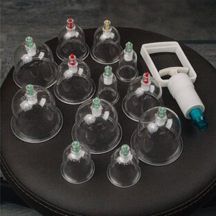 Вакуумные банки