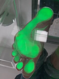 Обработка стоп