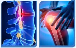 Витамины и минералы для хрящей, суставов и костей