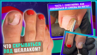 ШЕЛЛАК