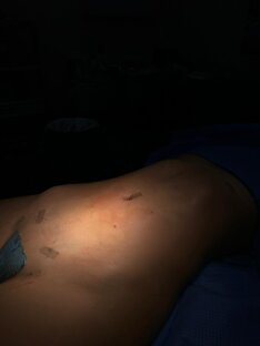 Ответы на вопросы о липо