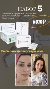 Кейс