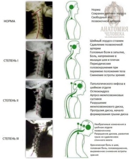 Болит спина