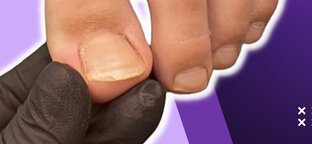 СТРИЖЕМ НОГТИ ПРАВИЛЬНО 