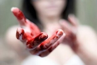 Ампутация матки.