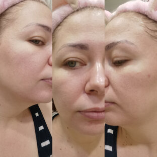 Маски для лица 