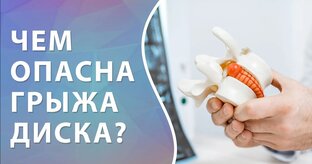 Все что нужно знать о грыжи позвоночника