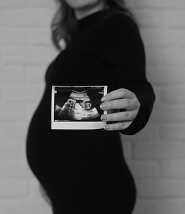 Моя беременность 🤰🏼