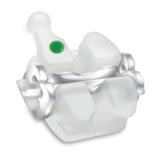 Исправление прикуса