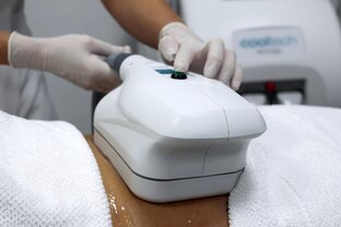 Криолиполиз Cooltech (Coccon)