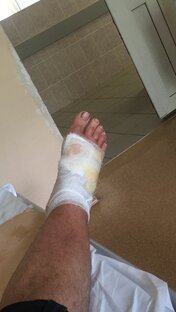 Как я попал в больницу