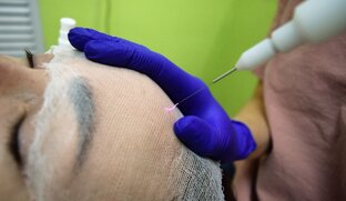 Холодная плазма