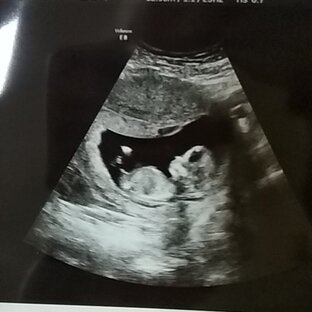 Наше маленькое счастье 