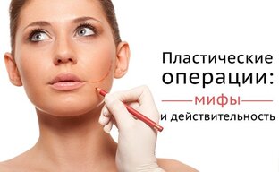 Мифы