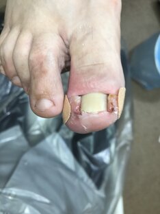 ВН сложная работа 