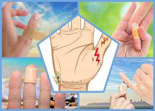 Трактовка порезов на пальцах руки. 5 частей.