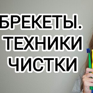 Брекеты. Мой опыт