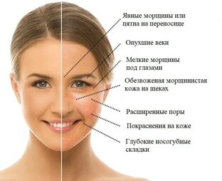 Отеки и ожирение