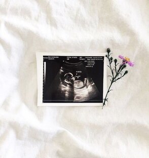 Интересные факты о беременности 