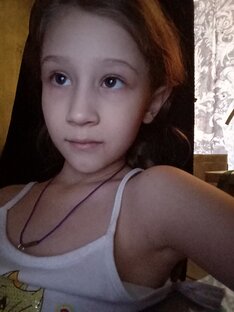 Бедные волосы