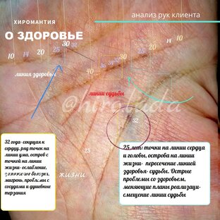 О здоровье в хиромантии