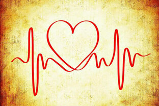 Аритмии. ЭКГ. 