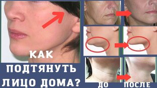 ЛИФТИНГ ЛИЦА ДОМА