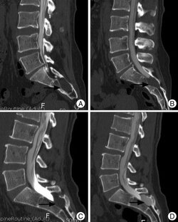 ДИАГНОСТИКА ПОЗВОНОЧНИКА