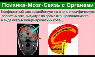 Новая Германская Медицина