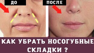 УБРАТЬ НОСОГУБНЫЕ СКЛАДКИ