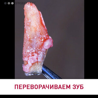 РЕПЛАНТАЦИЯ