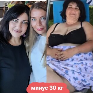 До После