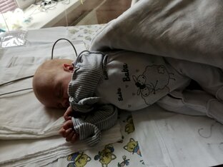 История преждевременных родов