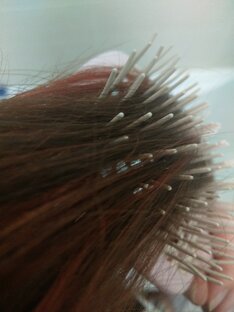 О выпадении волос