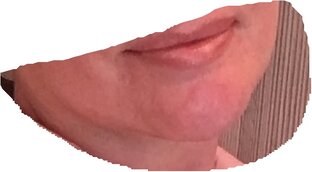 практики на нижнюю треть лица и шею