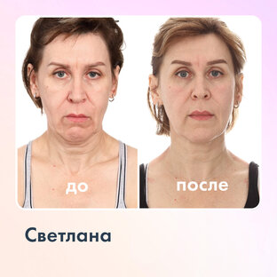 Истории преображения 