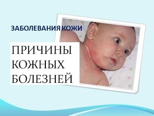 Заболевания кожи