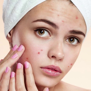 Дзен акне 18+ статистика