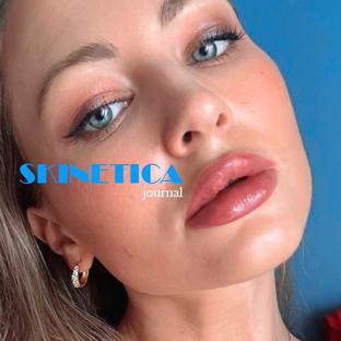 Статистика Дзен SKINETICA