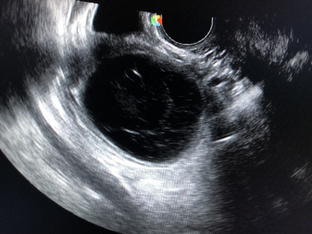 Случай из практики