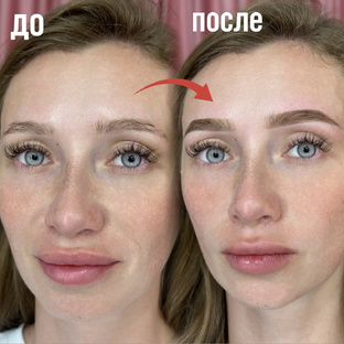 Брови