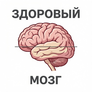 Здоровый МОЗГ