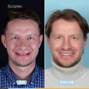 Истории пациентов Simplex Clinic