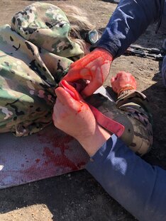 Остановка кровотечение (наружные)