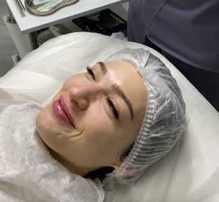 Уход за кожей и омоложение