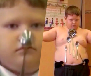 Аномалии человеческого тела