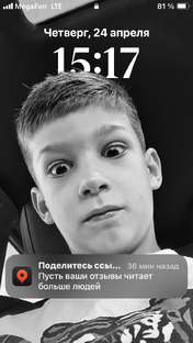  Как в Standoff два получить медаль