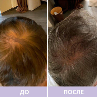 Восстановление волос