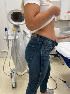 Коррекция фигуры