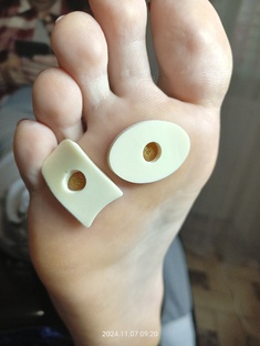 Разгрузка при бородавки